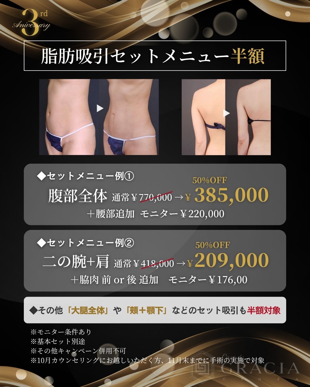 3周年キャンペーン③