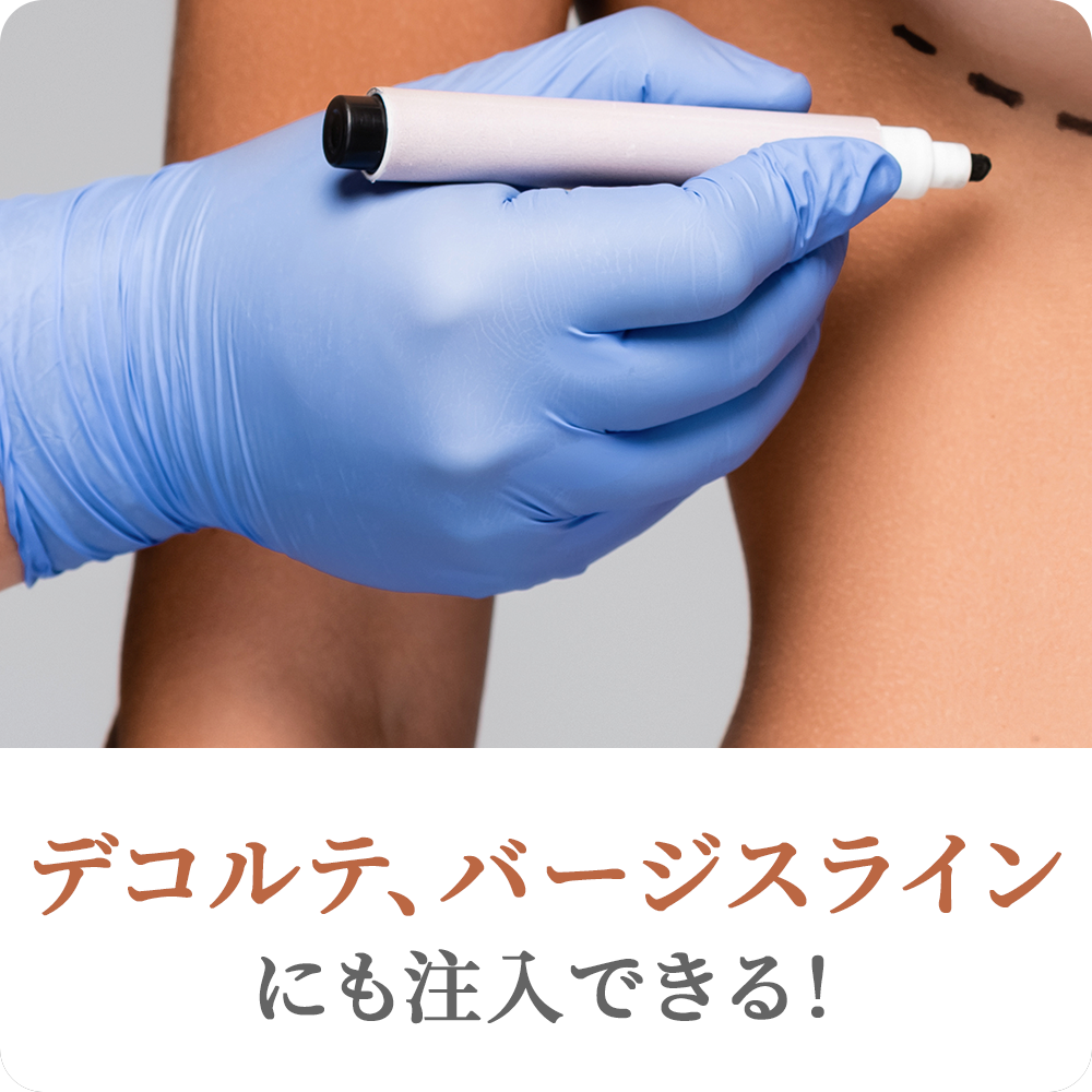 デコルテ、バージスラインにも注入できる！